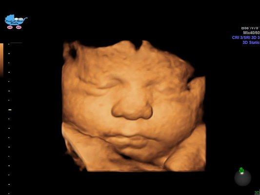 3D of baby in 3rd trimester