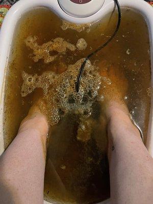 Ionic Foot Bath Detox Cleansing Treatments