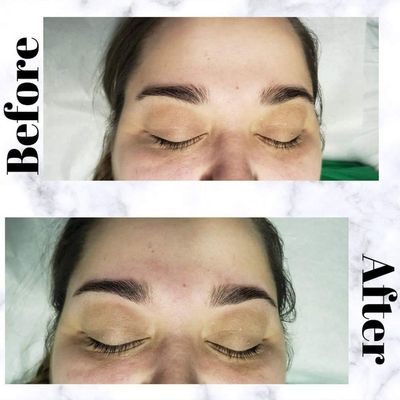 Brow transformation