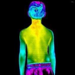 Full body scan of boy with thermography instead of radiation