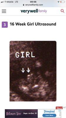 Caylilly In first ultrasound/sonogram taken in Santa Barabara, California. Eva Talavera