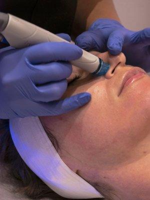 HydraFacial cleanses, exfoliates and hydrates to remove dead, dull skin and bring brighter skin to the surface.