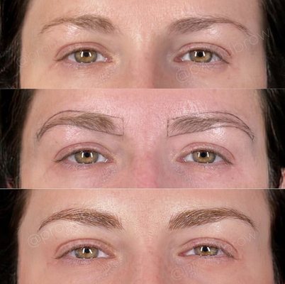 Client before microblading treatment, mapped (during treatment), and immediately after