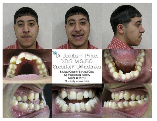 Douglas Prince, DDS