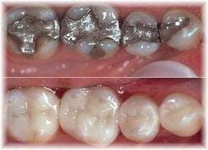 This is what Cerec Technology can do in 1 Visit