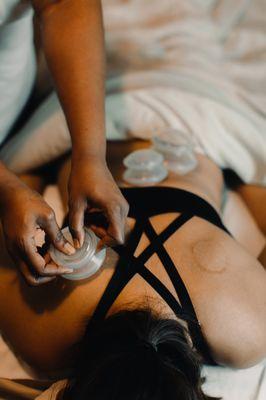 Cupping Therapy