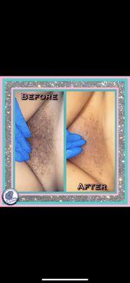 $40 BRAZILIAN WAXING