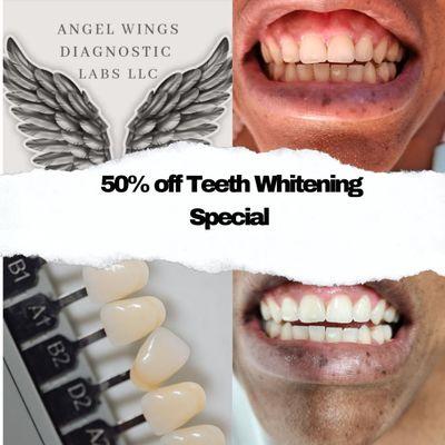 Teeth Whitening Special