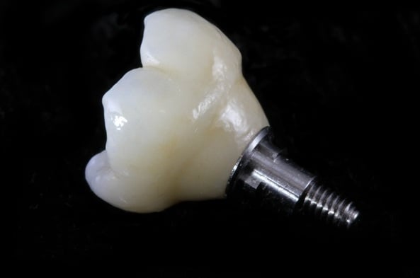 BruxZir Solid Zirconia Implant