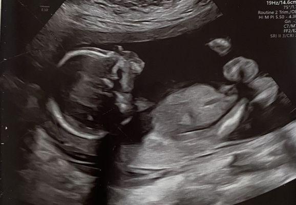 2D ultrasound profile picture