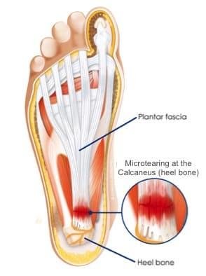 Anatomy of plantar fasica