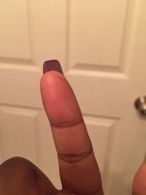 Nails all leaning like this smh