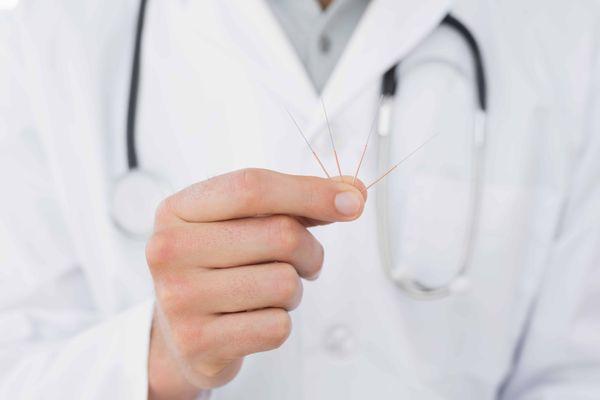 Actual size of an acupuncture needle (very small)