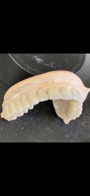 One of our upper arch for a full mouth reconstruction