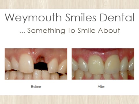 Cosmetic Dentist East Weymouth, MA