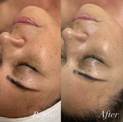 Diamond Glow Facial results.