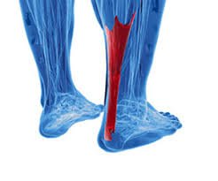 ACHILLES TENDON PAIN