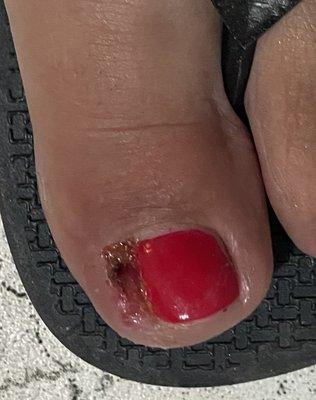 Next day after getting my pedicure