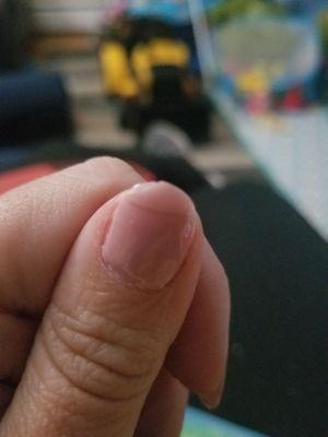 Chipped and cracked nail