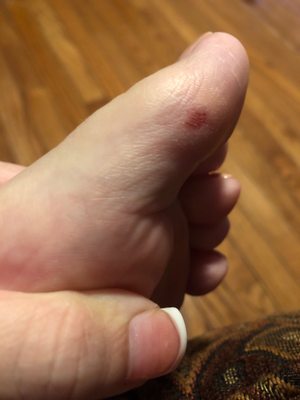 Cut on my toe while doing the bottom of my feet