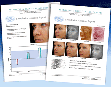 Digital Skin Analysis is complementary at ALVC