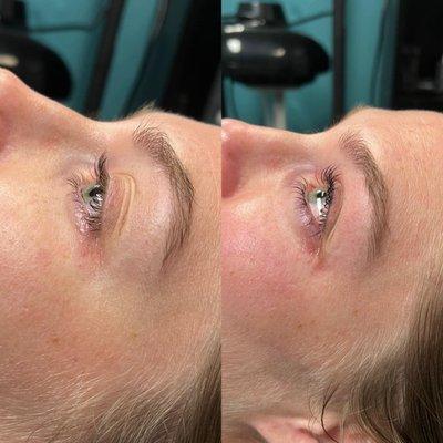 Lash lift & tint