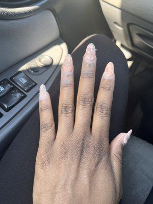 This is how they left my nails.