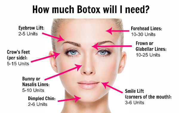 How much Botox will I need?