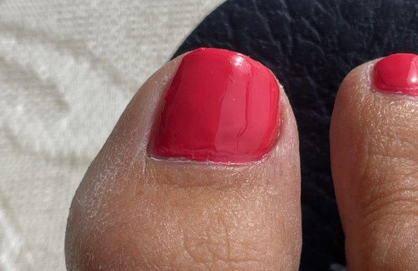 Bad polish on large toe and dry skin on side never addressed