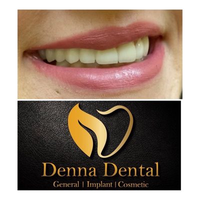 Denna Dental