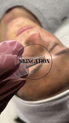 Skincation