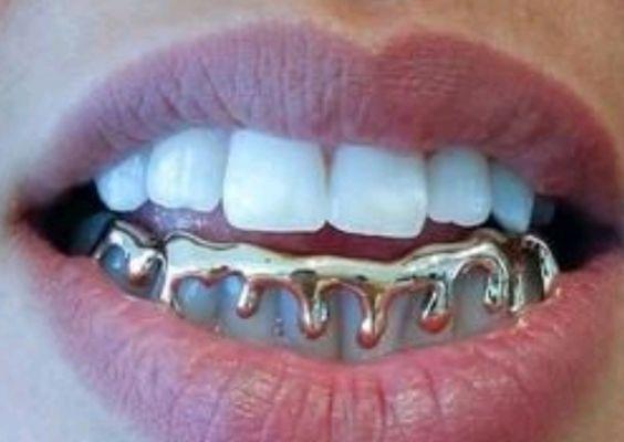 Gold Drip Grillz