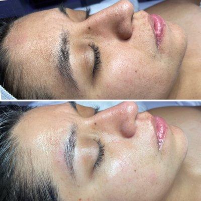 Rejuvenating Facial!