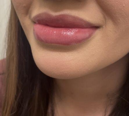 Keeping Lips as Natural as Possible..