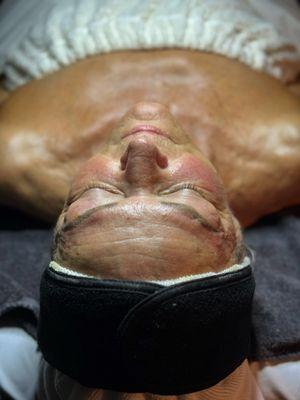 Facial