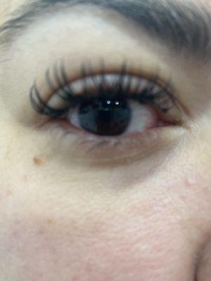 Irritating red and burning from lash extensions.