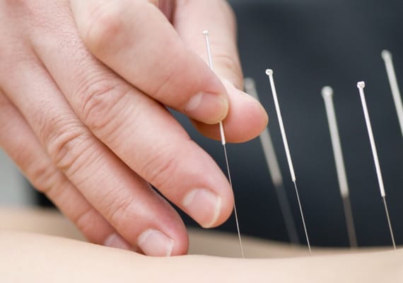 Claudia Olson Acupuncture