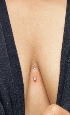 Sternum surface piercing 2 days later :)