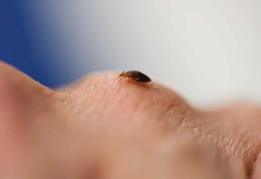 Bed bug on hand.