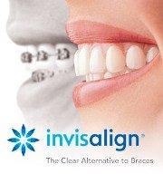 Ask about our end of year savings on ALL Invisalign cases!