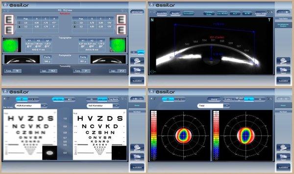 Wave Front Analyzation