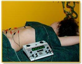 Electro Acupuncture