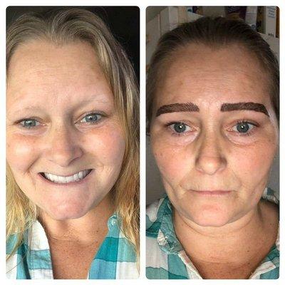 Before and after treatment