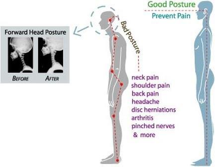 Good Posture plays a major role on your spine ! Always keep it straight ! ‍‍