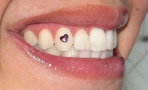 Heart  tooth gem