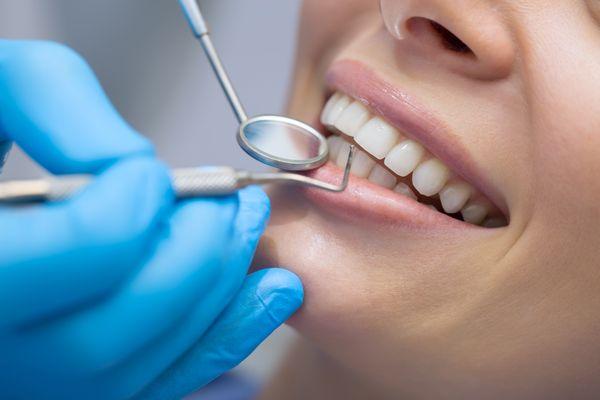 Delicate Dentistry of Palm Harbor