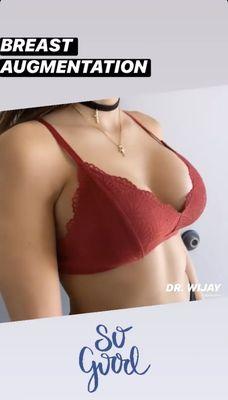 Breast Augmentation Houston