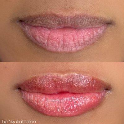 Lip Neutralization