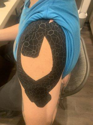 Kinesiology Taping