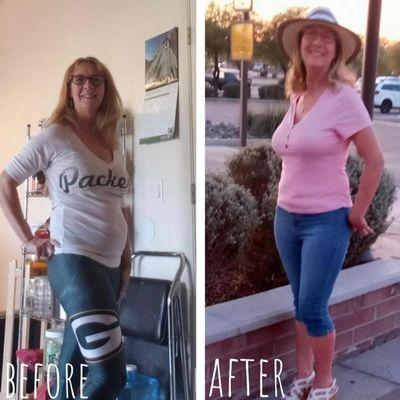 Valerie lost her belly fat and then tightened and toned.